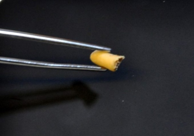 Nefes alamıyordu burnundan çıkan şok etti 5