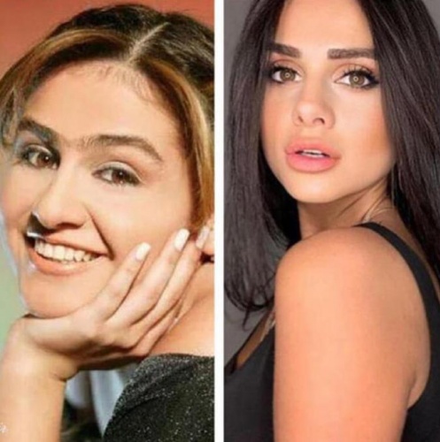 Günel'in son hali şaşırttı 6