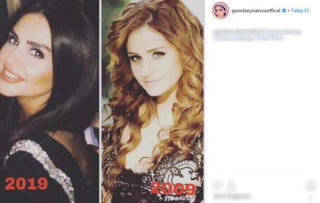 Günel'in son hali şaşırttı 7