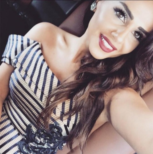 Günel'in son hali şaşırttı 3