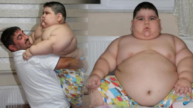 4 yaşında 70 kilo! 15