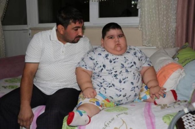 4 yaşında 70 kilo! 10