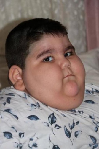 4 yaşında 70 kilo! 11