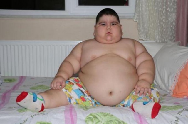 4 yaşında 70 kilo! 9