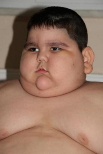 4 yaşında 70 kilo! 2