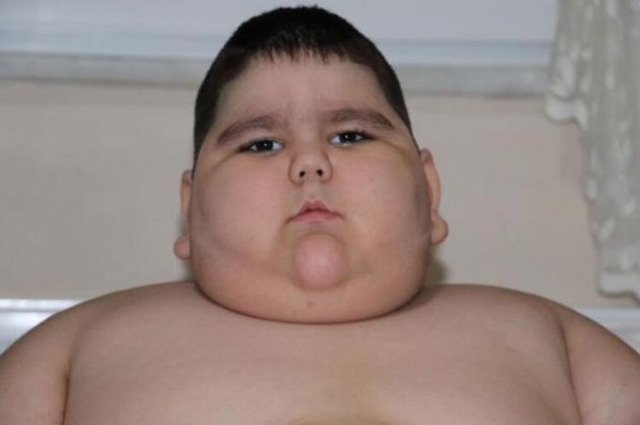 4 yaşında 70 kilo! 6