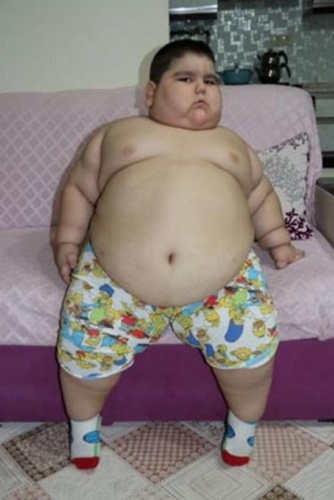 4 yaşında 70 kilo! 3