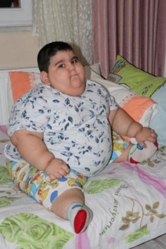 4 yaşında 70 kilo! 12