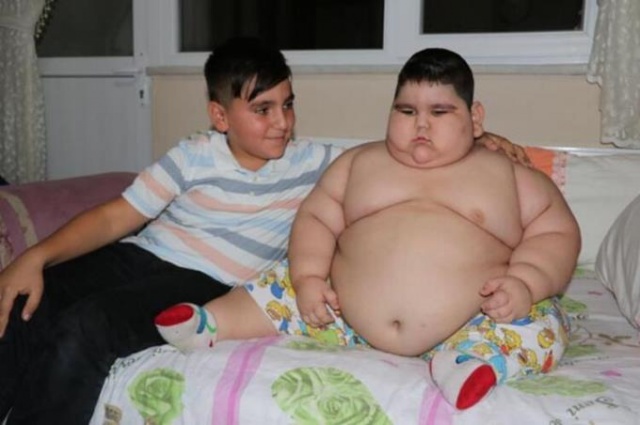 4 yaşında 70 kilo! 16