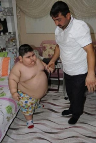 4 yaşında 70 kilo! 4