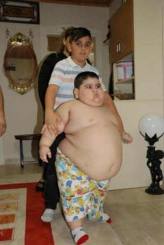 4 yaşında 70 kilo! 14