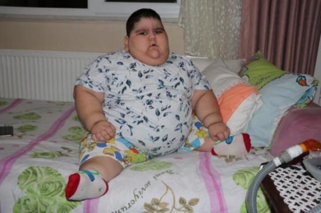 4 yaşında 70 kilo! 8