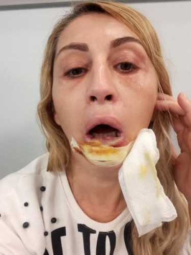 Güzellik uğruna bu hale geldi 11