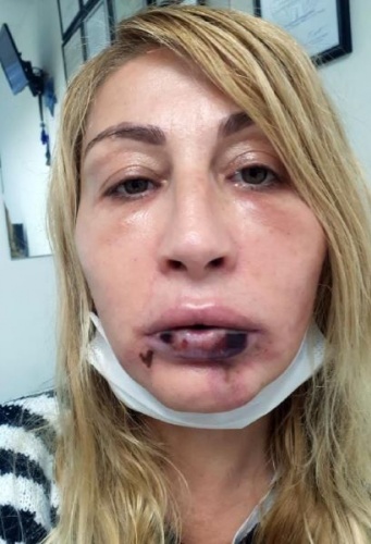 Güzellik uğruna bu hale geldi 13