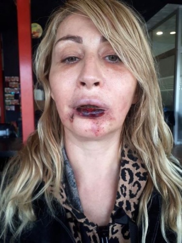 Güzellik uğruna bu hale geldi 5