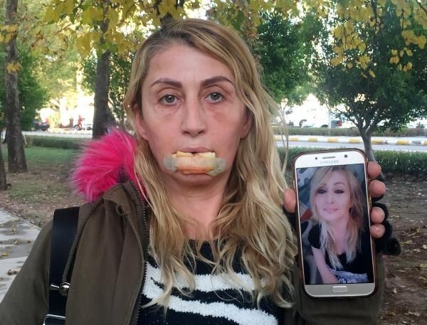 Güzellik uğruna bu hale geldi 2