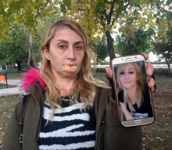 Güzellik uğruna hayatı karardı 14