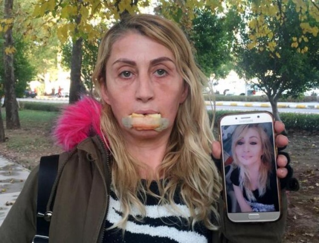 Güzellik uğruna hayatı karardı 10