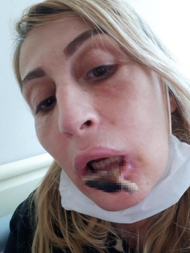 Güzellik uğruna hayatı karardı 7