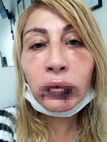 Güzellik uğruna hayatı karardı 12