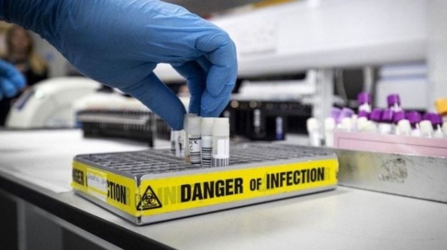 Koronavirüs altını uçurdu 9