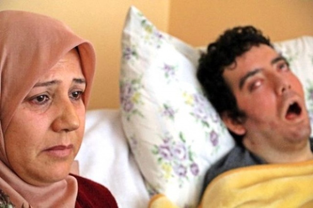 Yıllardır gözlerini kapatamıyor! Genç dansçının görüntüsü yürekleri dağladı 3