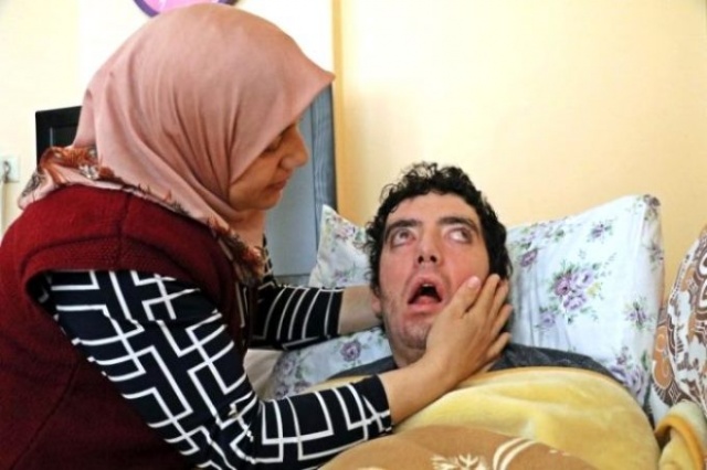 Yıllardır gözlerini kapatamıyor! Genç dansçının görüntüsü yürekleri dağladı 5