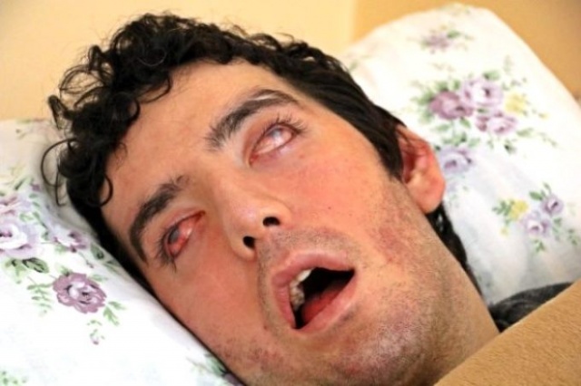 Yıllardır gözlerini kapatamıyor! Genç dansçının görüntüsü yürekleri dağladı 2