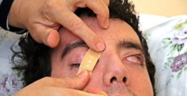 Yıllardır gözlerini kapatamıyor! Genç dansçının görüntüsü yürekleri dağladı 4