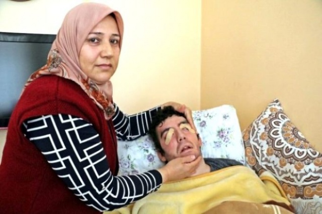 Yıllardır gözlerini kapatamıyor! Genç dansçının görüntüsü yürekleri dağladı 8