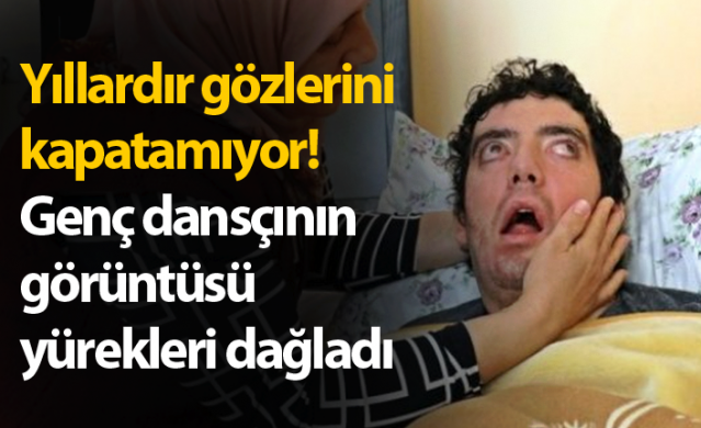 Yıllardır gözlerini kapatamıyor! Genç dansçının görüntüsü yürekleri dağladı 1