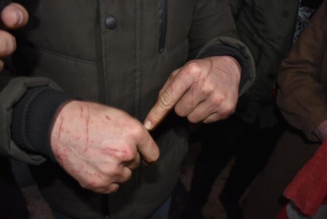 Yunan polisi dövüp, soyup geri yolladı... 6