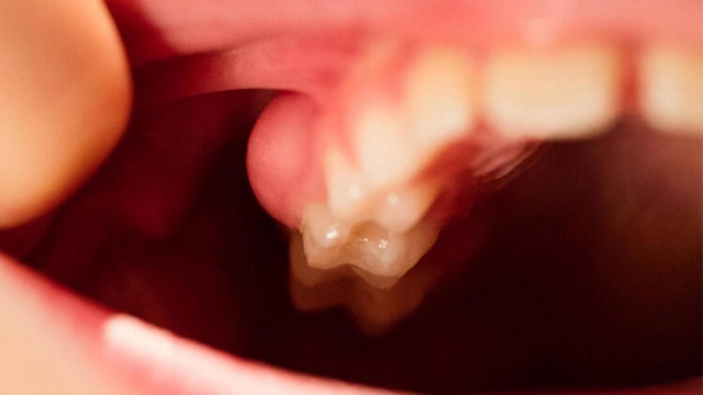 C vitamini eksikliğini gösteren 10 erken işaret 1