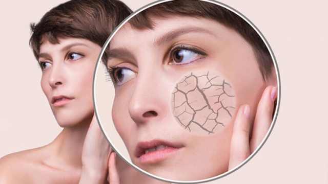 C vitamini eksikliğini gösteren 10 erken işaret 8