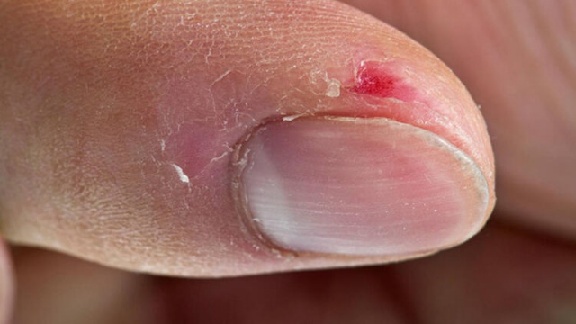 C vitamini eksikliğini gösteren 10 erken işaret 10