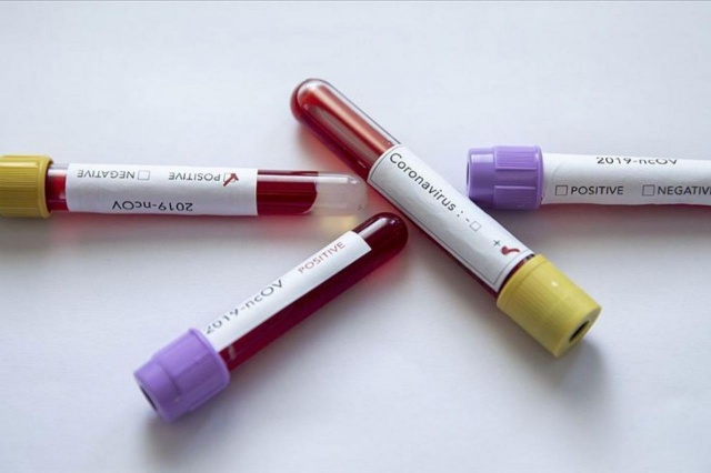 Bilim adamları açıkladı: İki tip koronavirüs var! 3