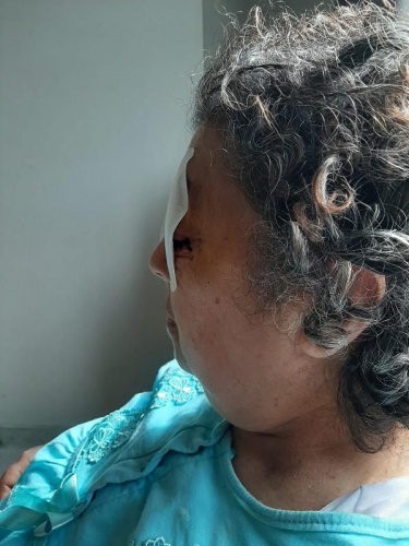 Oda arkadaşı gözlerini oydu 6