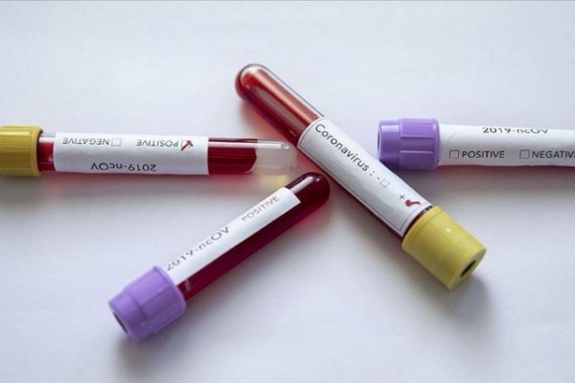 Koronavirüse karşı hazırlıklı mıyız? 5