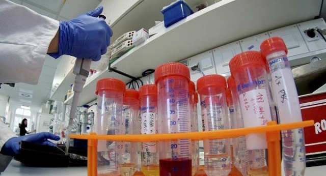 Kan gruplarına göre koronavirüs bulaşma riski! 9