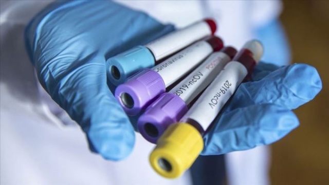 İngiltere'de corona virüsten 54 yaşında bir Türk öldü 8