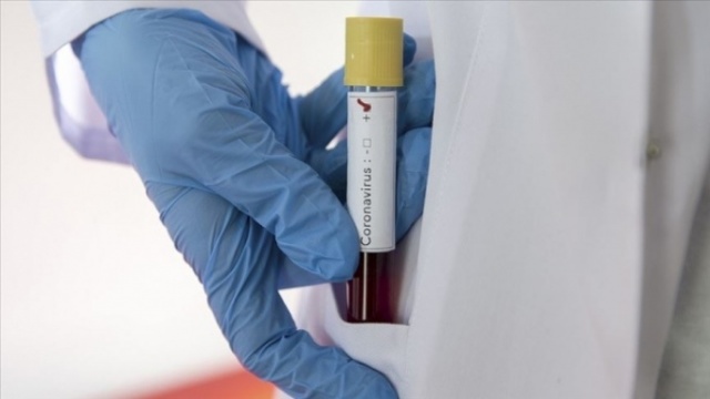 Virüsün yayılması ne zaman duracak ? 4