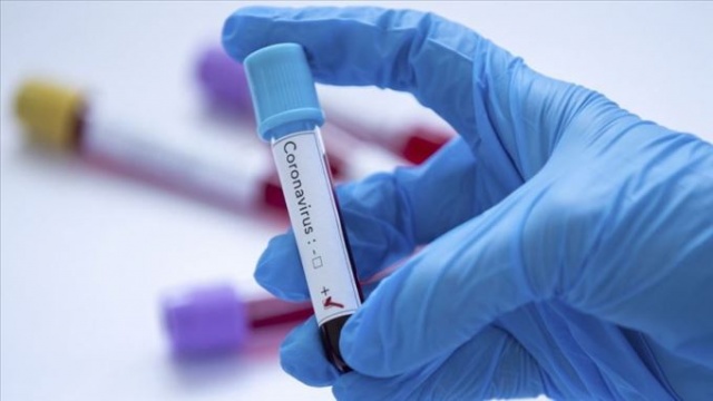 Koronavirüs tedavisinde sevindiren haber! 4