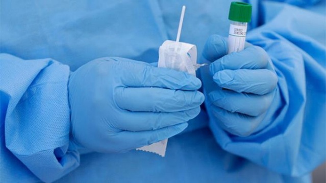 Bunu da yaptılar! Corona virüs testi özel laboratuvarda 1200-1250 liraya yapılıyor. 5