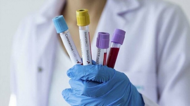 Dikkat bunlar da koronavirüs belirtisi 3