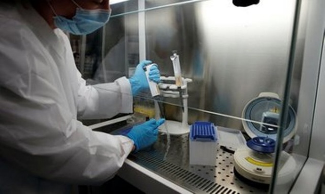 Dikkat bunlar da koronavirüs belirtisi 7