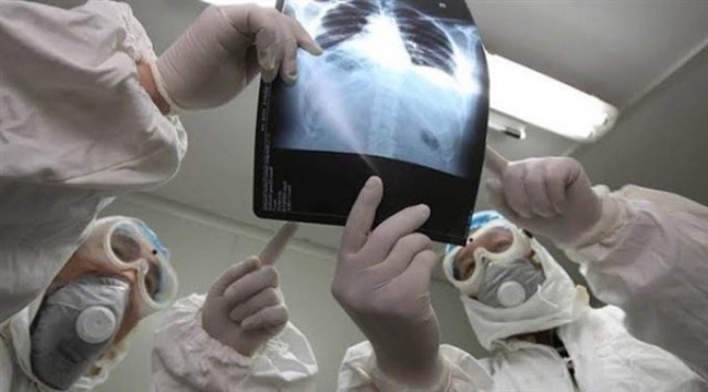 İşte gün gün koronavirüs belirtileri 9