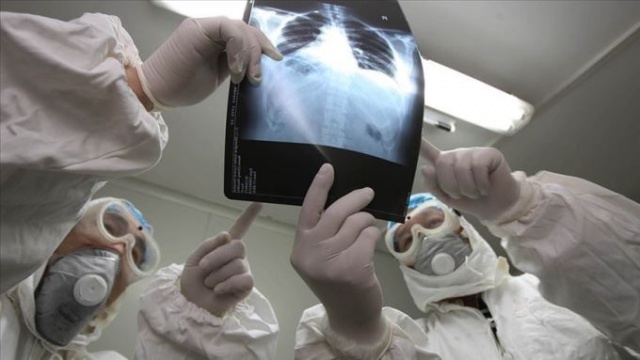 "Salgın 3 yolla bitebilir" 4