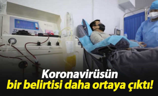 Koronavirüsün bir belirtisi daha ortaya çıktı. 1