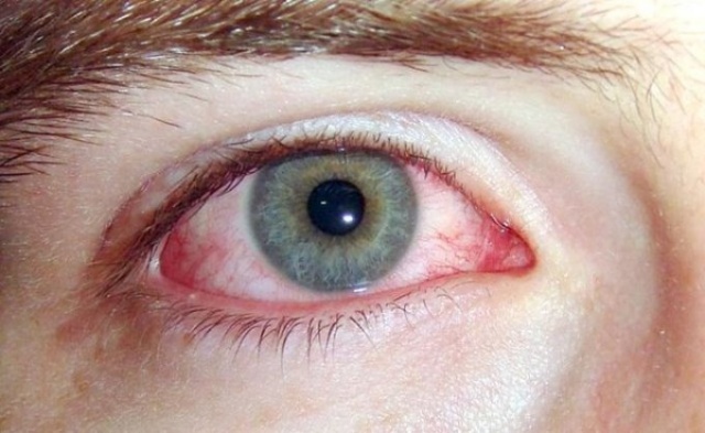 Koronavirüsün bir belirtisi daha ortaya çıktı. 3