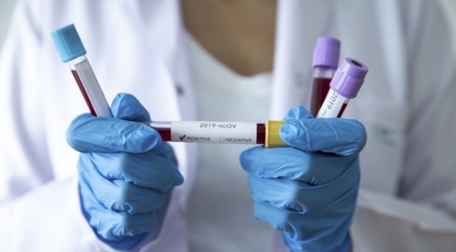 Koronavirüs en uzun hangi sıcaklıkta yaşıyor? 2